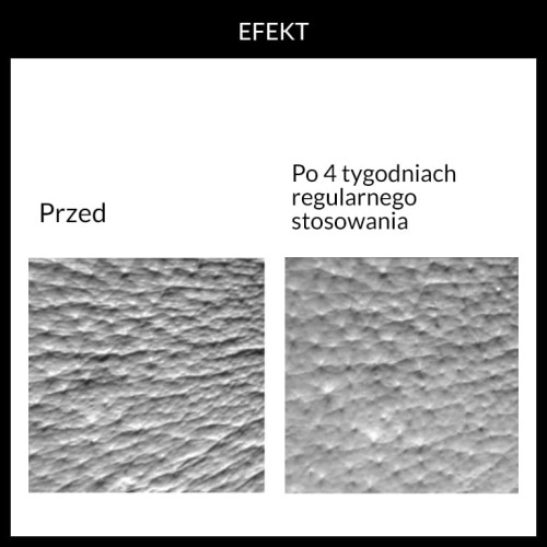 4.7 efekt.jpg